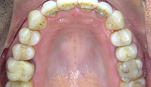 Zahnheilkunde - Tierarztpraxis Dr. Gerhardus Hachenburg